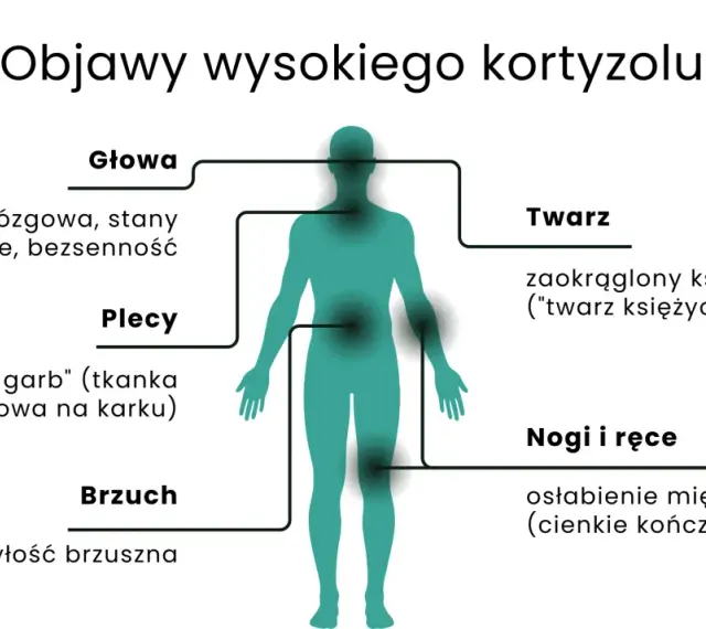 Objawy wysokiego kortyzolu: mgła mózgowa, lęki, bezsenność, "wdowi garb", otyłość brzuszna, okrągła twarz, osłabienie mięśni.