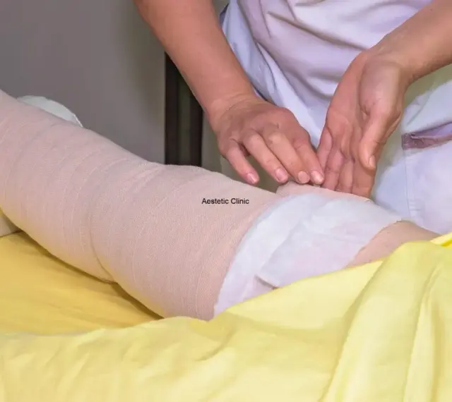 Noga owinięta bandażem kompresyjnym, ręce terapeuty.