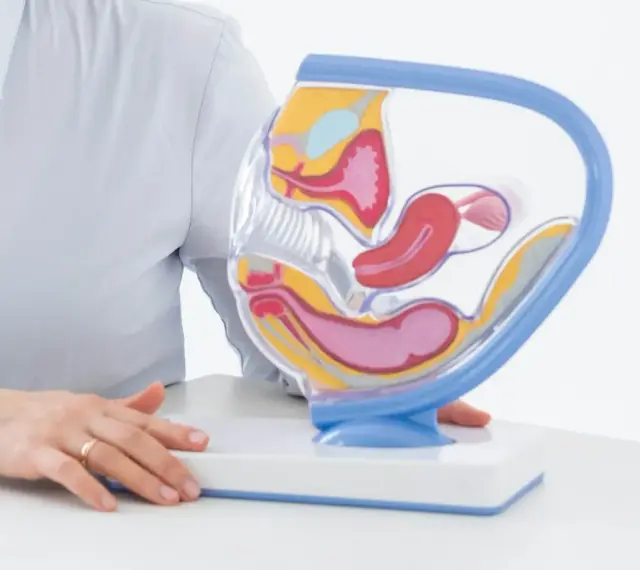 Model anatomiczny narządów rodnych kobiety. W tle osoba w jasnej koszuli, która może wyjaśniać procedurę biopsji endometrium.