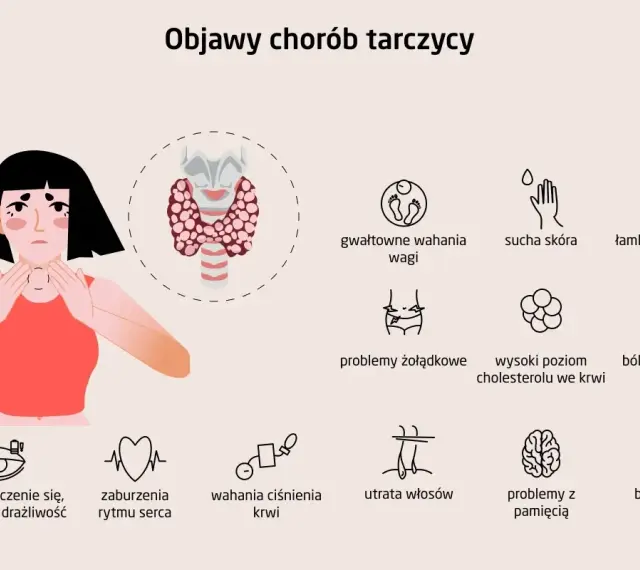 Ilustracja pokazuje, gdzie jest tarczyca, i objawy jej chorób: zmęczenie, problemy z wagą, skórą, paznokciami, sercem, włosami i pamięcią.