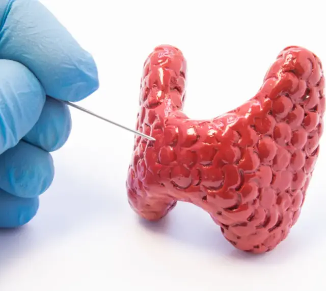 Ręka w niebieskiej rękawiczce wykonuje biopsję tarczycy, pobierając próbkę z czerwonego modelu gruczołu.