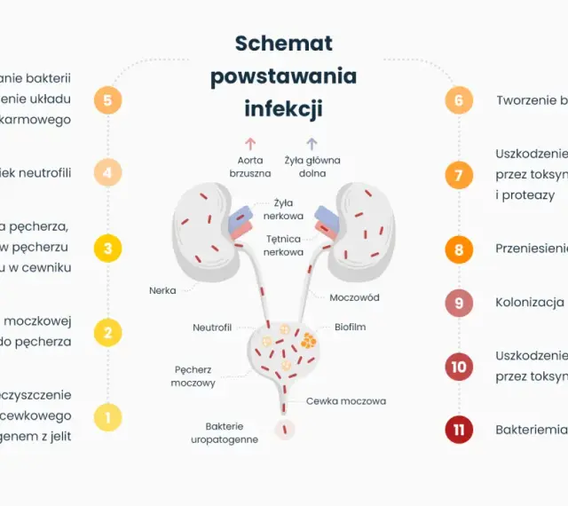 Schemat powstawania infekcji, od zanieczyszczenia do zapalenia pęcherza i nerek. Bakterie uropatogenne kolonizują cewkę moczową, pęcherz, a następnie nerki.