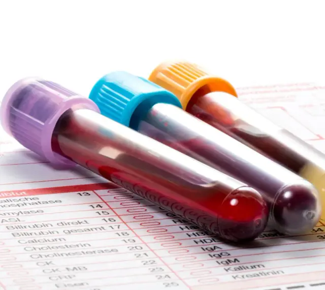 Trzy probówki z krwią na tle formularza laboratoryjnego z listą badań, w tym CRP.