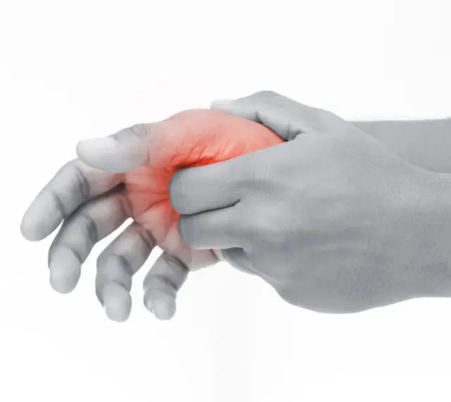 Hand mit roter Markierung am Daumenballen innen, die auf Schmerzen hindeutet.