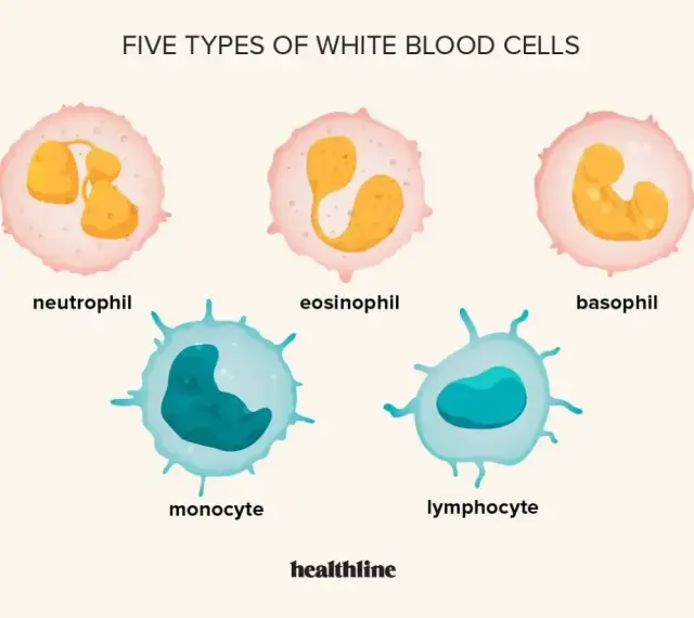 Pięć typów białych krwinek: neutrofil, eozynofil, bazofil, monocyt, limfocyt. Zwiększona liczba białych krwinek to leukocytoza.