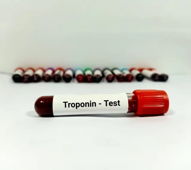 Probówka z oznaczeniem "Troponin - Test" na tle rzędu innych próbek krwi.