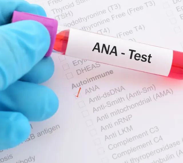 Ręka w niebieskiej rękawiczce trzyma probówkę z krwią do testu ANA. Na formularzu zaznaczono ANA.