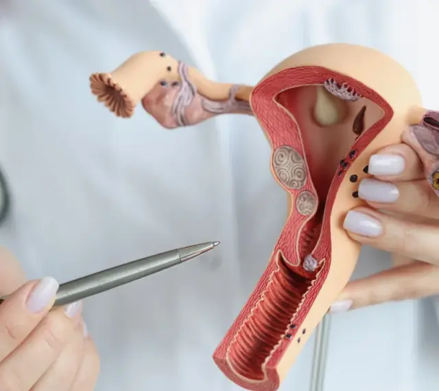 Model anatomiczny narządów rodnych kobiety, prezentowany przez lekarza z długopisem.