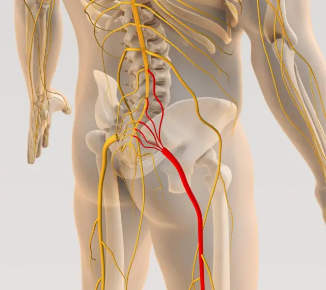 Anatomia układu nerwowego z zaznaczonym nerwem w kolorze czerwonym, wskazującym na potencjalną stenoza kanału kręgowego.