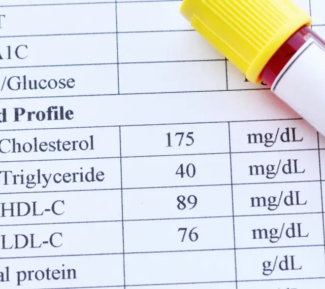 Wynik lipidogramu: cholesterol 175, trójglicerydy 40, HDL-C 89, LDL-C 76 mg/dL. To badanie ocenia profil lipidowy.