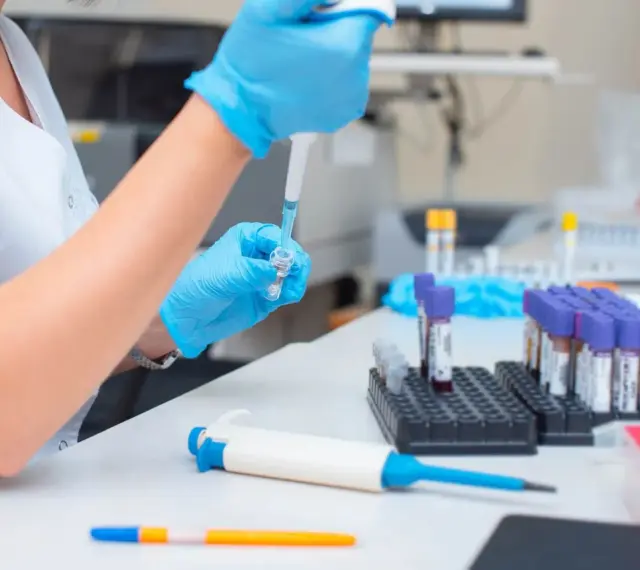 Laborantka w niebieskich rękawiczkach pobiera próbkę pipetą do probówki.