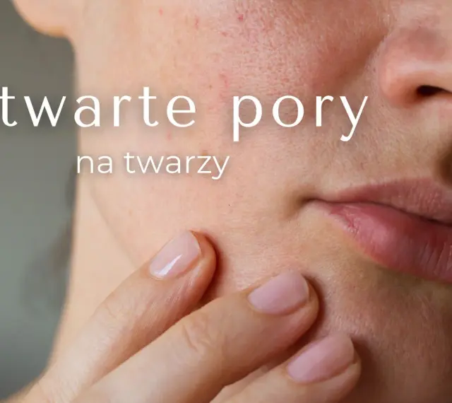 Zbliżenie na skórę twarzy z widocznymi, otwartymi porami. Dłoń delikatnie dotyka policzka, podkreślając tekst "Otwarte pory na twarzy".