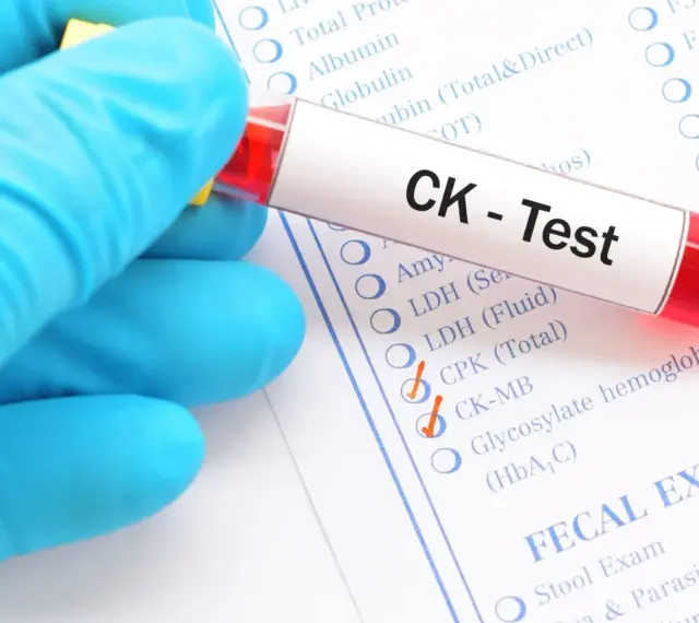 Ręka w niebieskiej rękawiczce trzyma probówkę z krwią do testu CK. Na formularzu zaznaczono CK-MB, co może wskazywać na badanie kinazy kreatynowej.