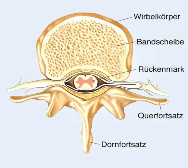 Querschnitt eines Wirbels mit Bandscheibe und dem zentralen Rückenmark.