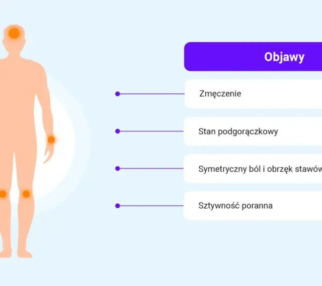 Ilustracja przedstawia objawy reumatoidalnego zapalenia stawów: zmęczenie, stan podgorączkowy, symetryczny ból i obrzęk stawów, sztywność poranną.