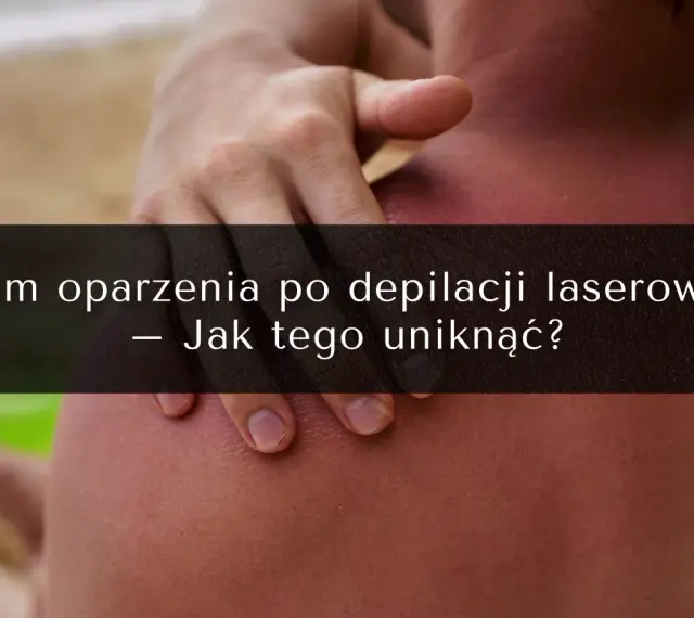 Oparzenia po depilacji laserowej to częsty problem. Zobacz, jak uniknąć powikłań i jakie są opinie o zabiegu.