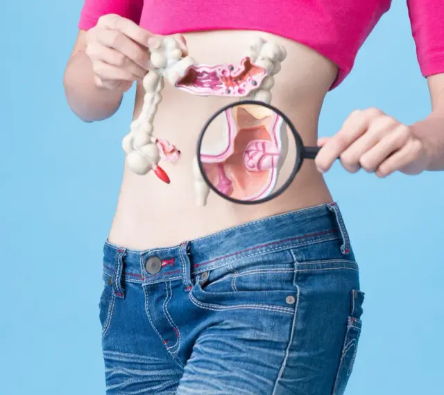 Model jelita z powiększeniem na uchylki esicy. Jak leczyć te schorzenia?