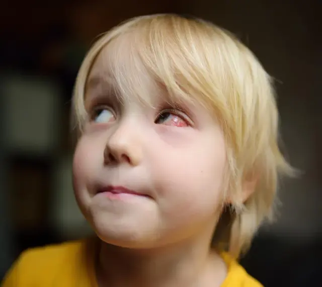 Mały chłopiec z blond włosami ma zaczerwienione, spuchnięte oko.