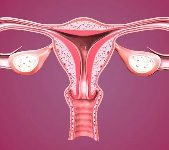Anatomia kobieca: macica, jajowody i jajniki. Widoczna rozpulchniona szyjka macicy, gotowa na przyjęcie życia.
