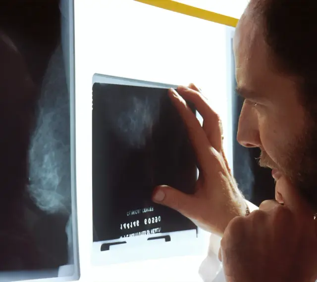 Lekarz analizuje mammografię, szukając oznak raka.