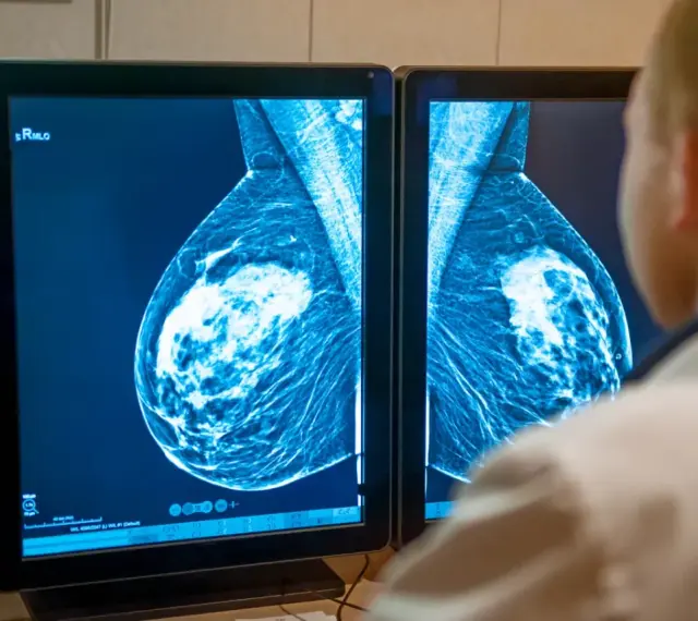 Lekarz analizuje mammografię piersi na ekranie. Wyniki badań, jak te z systemu armidex, są kluczowe dla wczesnego wykrywania.