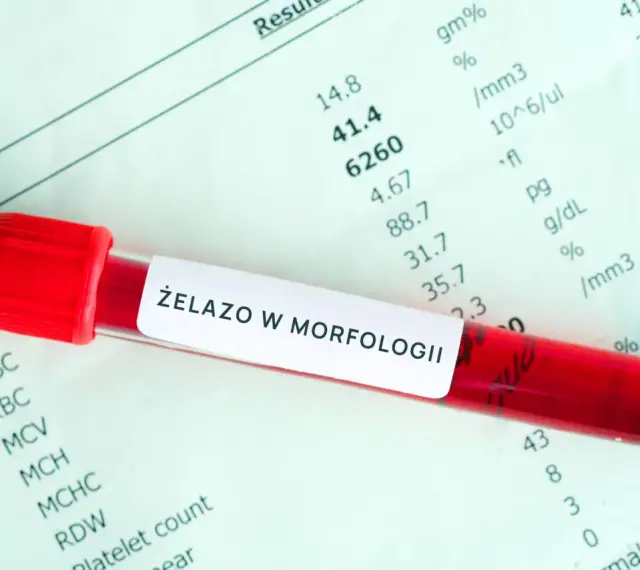 Czerwona probówka z krwią na tle wyników morfologii krwi z oznaczeniem "Żelazo w morfologii".