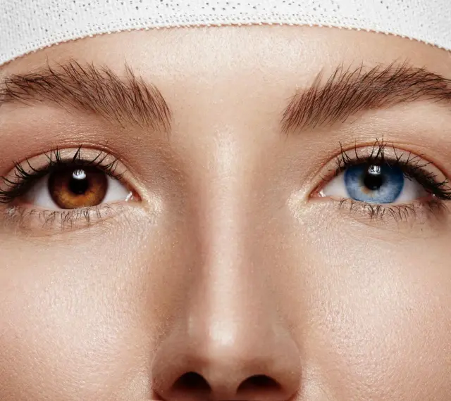 Oczy z heterochromią: jedno brązowe, drugie niebieskie. Delikatna opaska na głowie.