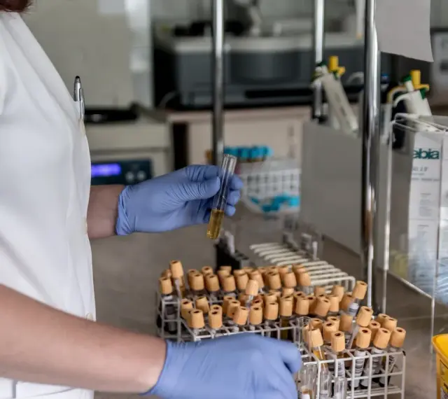 Laborantka w niebieskich rękawiczkach trzyma probówkę z żółtym płynem. W tle stoją liczne probówki i sprzęt laboratoryjny, sugerujący pracę nad analizą ccp.
