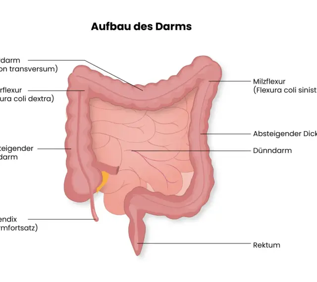 Der Aufbau des Darms: Dickdarm mit Querdarm, Leberflexur, aufsteigendem und absteigendem Dickdarm, Appendix, Rektum und dem zentralen Dünndarm.