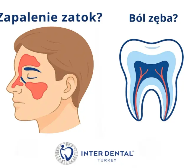 Zapalenie zatok czy ból zęba? Ilustracja przedstawia profil twarzy z zaznaczonymi zatokami oraz przekrój zęba z widocznymi nerwami.