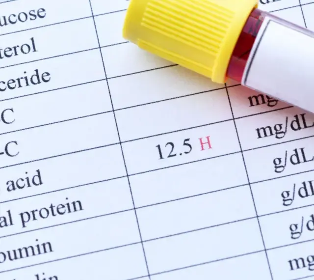Próbówka krwi na tle tabeli z wynikami badań, widoczny wpis "Uric acid" i wynik "12.5 H".