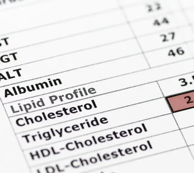 Wynik lipidogramu: cholesterol 2.25, trójglicerydy 1.0. Norma trójglicerydów jest kluczowa dla zdrowia.