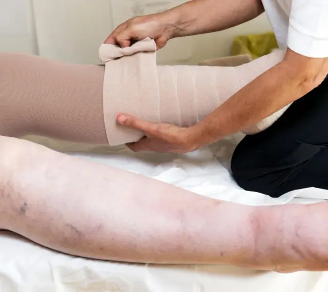 Beine werden bandagiert, um die Lymphdrainage selbst machen zu können.
