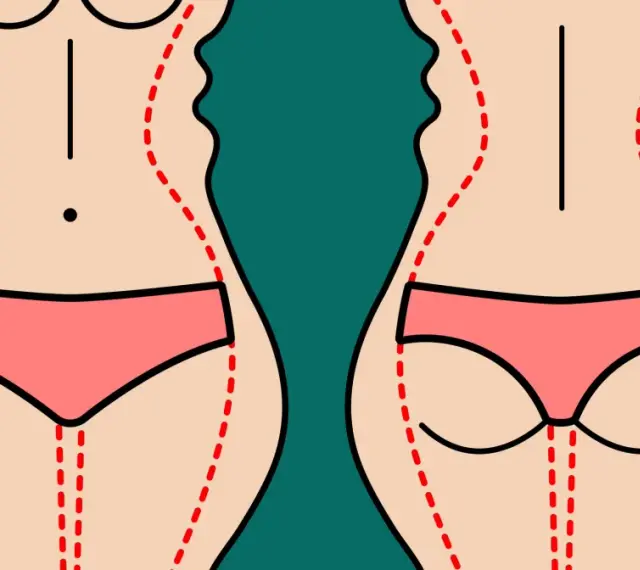 Ilustracja pokazuje sylwetkę przed i po zabiegu liposukcji ud. Czerwone linie zaznaczają obszary do modelowania.