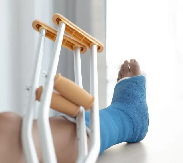 Noga w niebieskim gipsie, z kulami obok, sugeruje złamanie podudzia łącznie ze stawem skokowym.