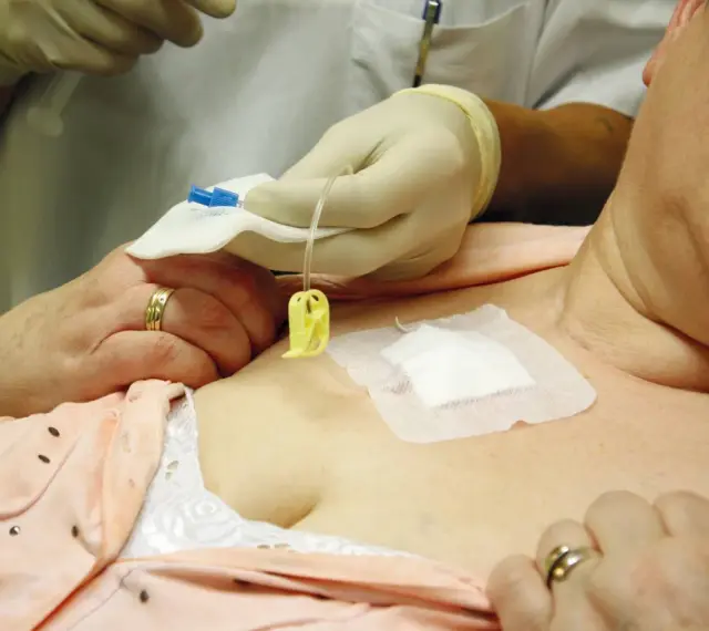 Eine Pflegekraft mit Handschuhen bereitet die Infusion an einem Port vene vor.