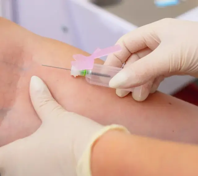 Pobieranie krwi do badań. Wyniki mogą wykazać, że limfocyty wysokie, co wymaga dalszej diagnostyki.