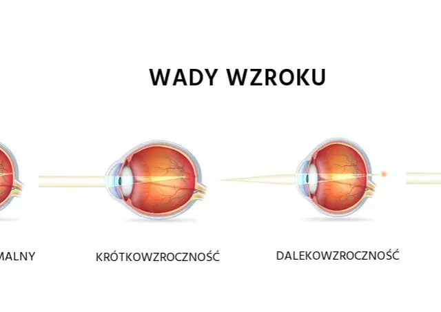 Krótkowzroczność a dalekowzroczność: Rozróżnij wady i zobacz lepiej!