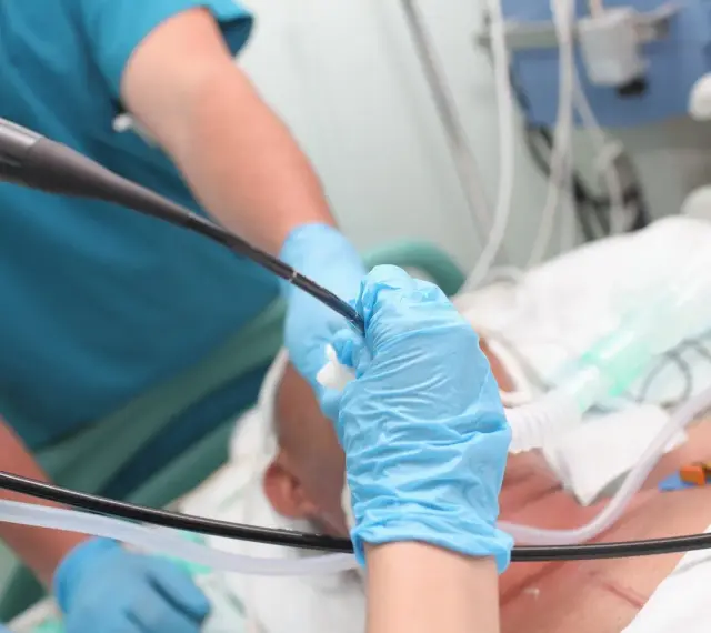 Lekarz w niebieskich rękawiczkach wykonuje bronchoskopię, wprowadzając endoskop do dróg oddechowych pacjenta podłączonego do aparatury medycznej.