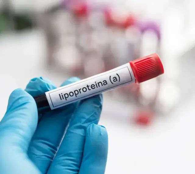 Ręka w niebieskiej rękawiczce trzyma probówkę z etykietą "lipoproteina (a)". Badanie poziomu tej lipoproteiny jest ważne.