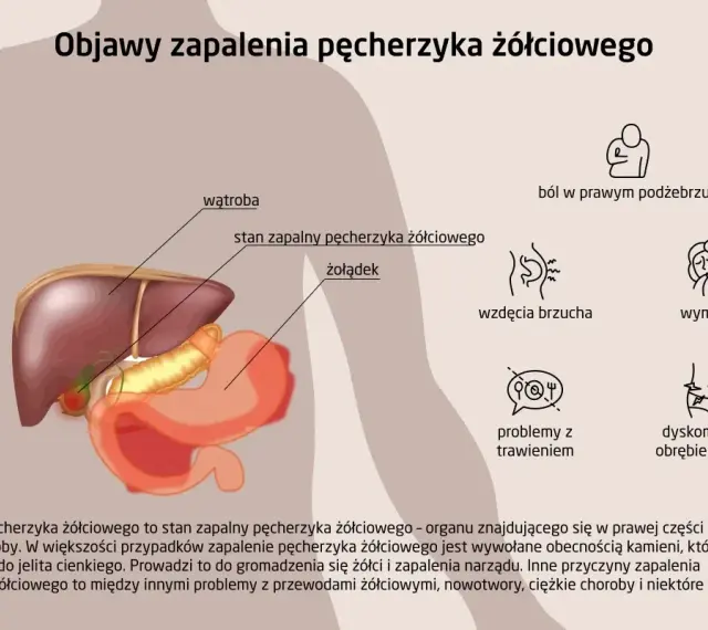 Anatomia człowieka z zaznaczonym pęcherzykiem żółciowym i objawami jego zapalenia: ból, wzdęcia, wymioty, problemy z trawieniem.