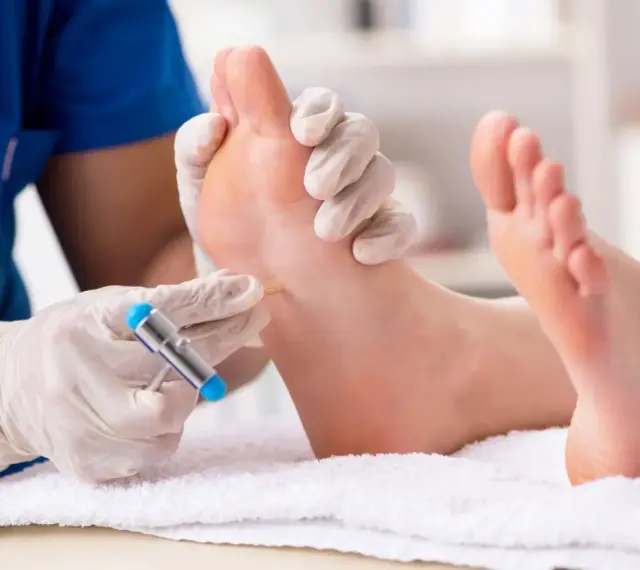 Badanie neurologiczne stopy, sprawdzanie odruchu Babińskiego za pomocą młoteczka.