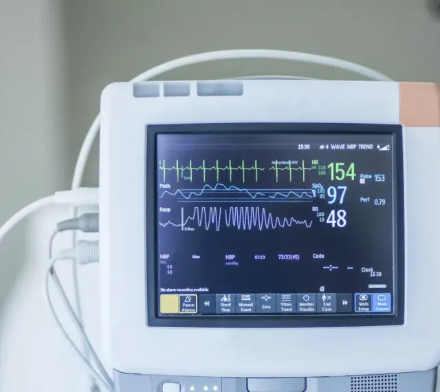 Monitor EKG pokazuje parametry życiowe: tętno 154, saturację 97, oddech 48. To jest co to ekg.
