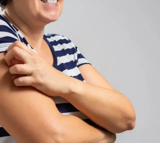Kobieta w pasiastym T-shircie drapie się po ramieniu, doświadczając bardzo nietypowe objawy menopauzy, takie jak swędzenie skóry.