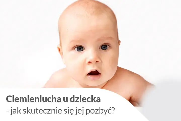 Urocze niemowlę z zaciekawioną miną. Tekst informuje o ciemieniuchy u dziecka i sposobach jej usuwania.