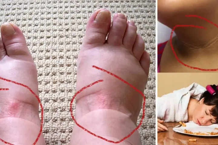Niski poziom insuliny objawy – jak je rozpoznać i co oznaczają?
