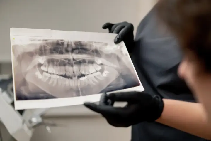 Pantomogram: Co dentysta widzi na zdjęciu? Ukryte problemy jamy ustnej