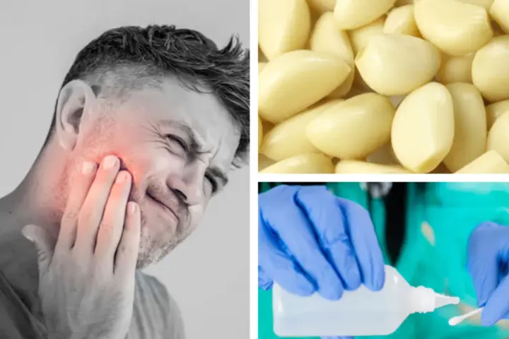 Ból zęba w nocy? Domowe sposoby na ulgę i kiedy iść do dentysty