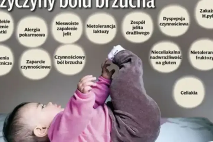 Dziecko z podkurczonymi nóżkami, nad którym widnieją kółka z przyczynami bólu brzucha u dziecka, np. nietolerancja laktozy.