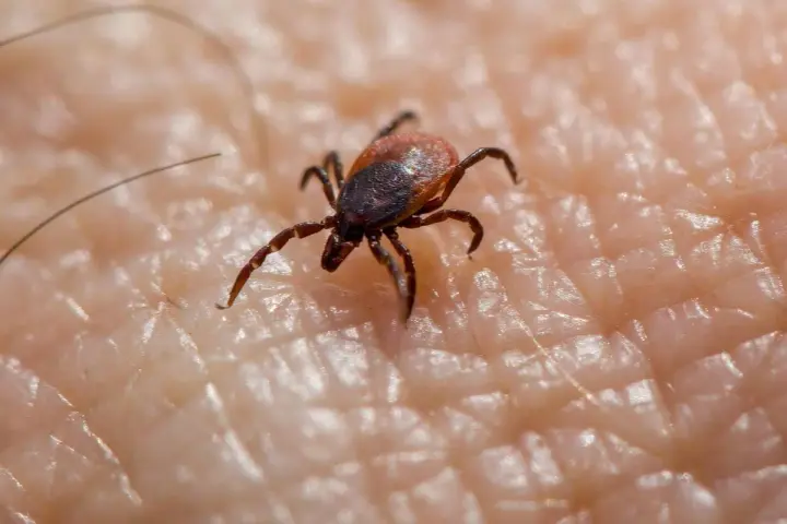 Garrapata en piel humana, un ejemplo de los tipos de garrapatas en España.